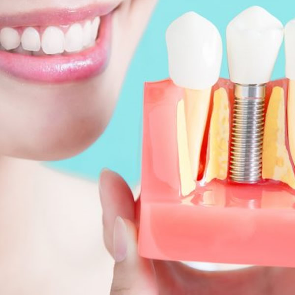 implant dentistry