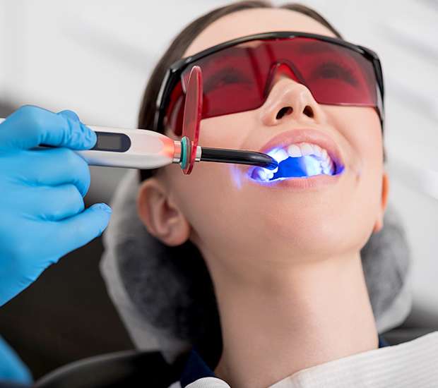 professional-teeth-whitening professional teeth whitening